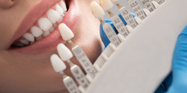 Dental implants in Swanage from Whitehall House Dental