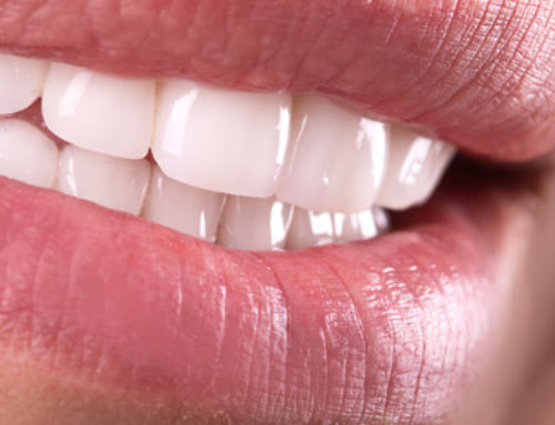 What do you need to know about tooth whitening law?